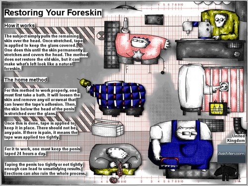 Cartoon: restoring your foreskin (medium) by bob schroeder tagged foreskin,diy,home,method,tape,comic,skin,natural