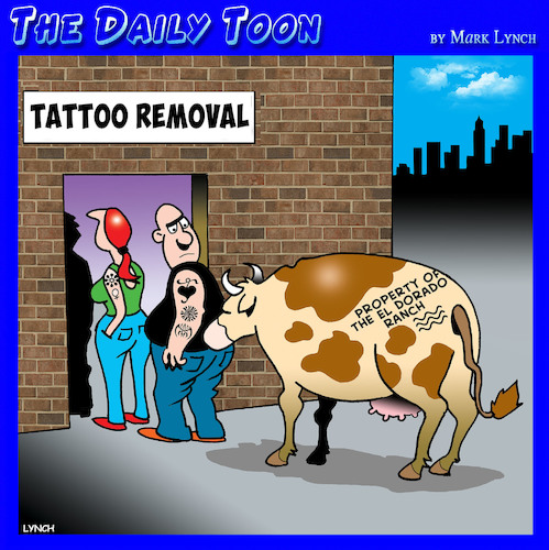 Tattoo removal