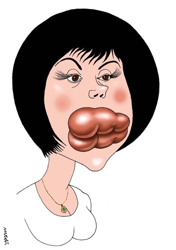 Cartoon: lips plastic syrgery (medium) by Medi Belortaja tagged women,woman,syrgery,plastic,lips,lip