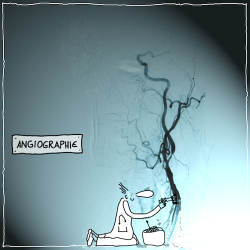 Cartoon: Angiographie (medium) by kika tagged röntgen,angiographie,diagnostik,krankenhaus,praxis,arzt,medizin,patient
